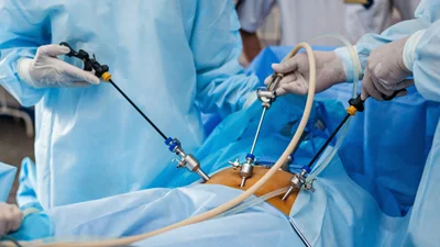 Laparoscopy Surgery